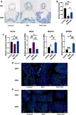 Metformin Exerts Anti-inflammatory and Mucus Barrier Protective Effects by Enriching Akkermansia muciniphila in Mice With Ulcerative Colitis